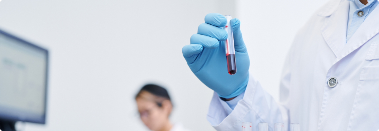Exames laboratoriais: 10 principais exames de rotina